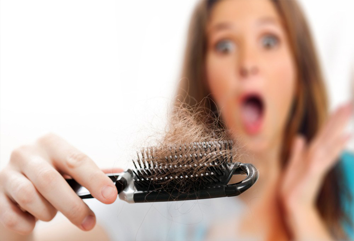 Алопеция, или выпадение волос