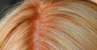 Как избавиться от желтизны волос при окрашивании в блонд
